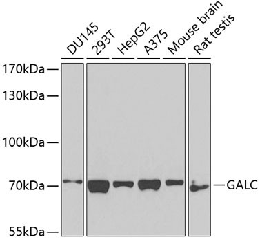 GALC Antibody in Western Blot (WB)