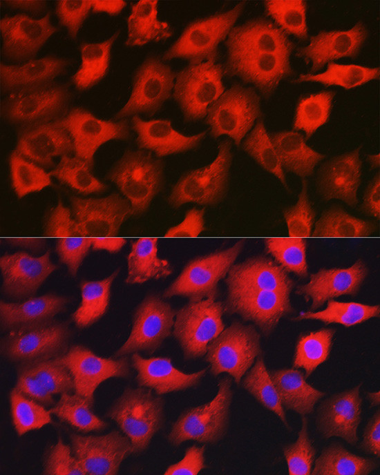 GAMT Antibody in Immunocytochemistry (ICC/IF)