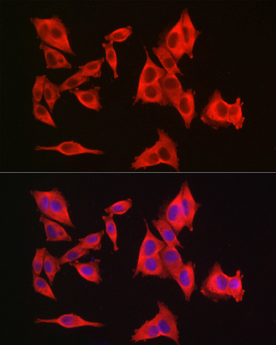 GAMT Antibody in Immunocytochemistry (ICC/IF)