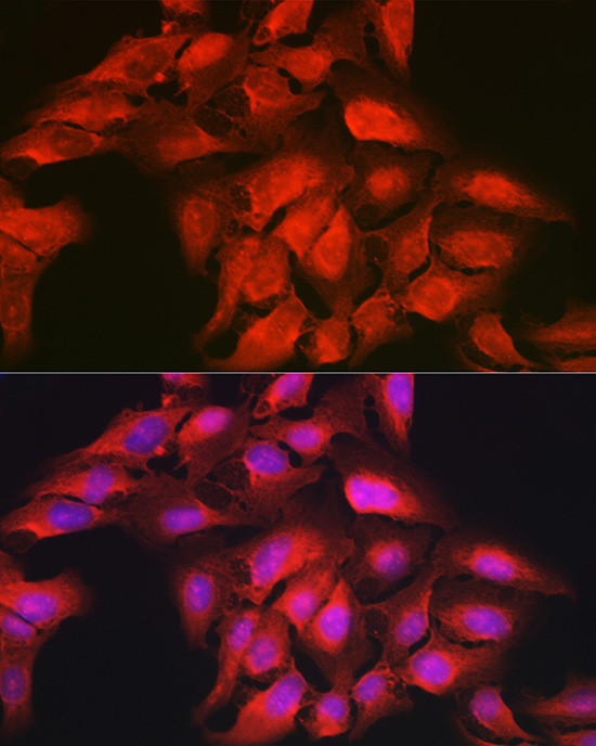 GAMT Antibody in Immunocytochemistry (ICC/IF)