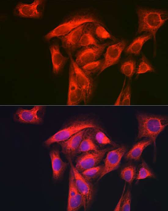 GART Antibody in Immunocytochemistry (ICC/IF)