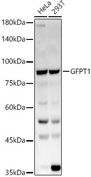 GFPT1 Antibody in Western Blot (WB)