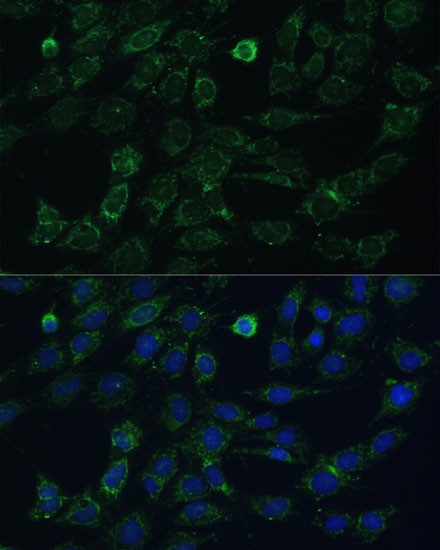 GK2 Antibody in Immunocytochemistry (ICC/IF)