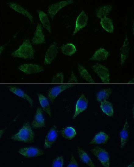 GK2 Antibody in Immunocytochemistry (ICC/IF)