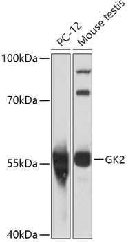 GK2 Antibody in Western Blot (WB)