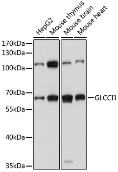 GLCCI1 Antibody in Western Blot (WB)