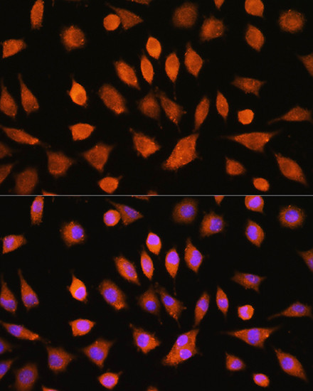 PI4KA Antibody in Immunocytochemistry (ICC/IF)