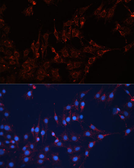 GNAI2 Antibody in Immunocytochemistry (ICC/IF)