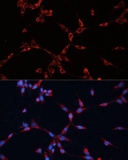 GNAI2 Antibody in Immunocytochemistry (ICC/IF)