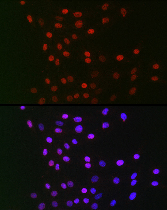 GPS1 Antibody in Immunocytochemistry (ICC/IF)