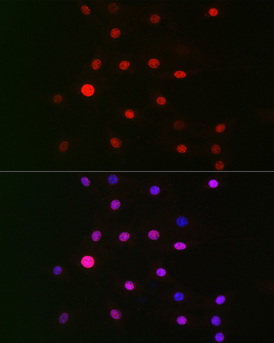 GPS1 Antibody in Immunocytochemistry (ICC/IF)