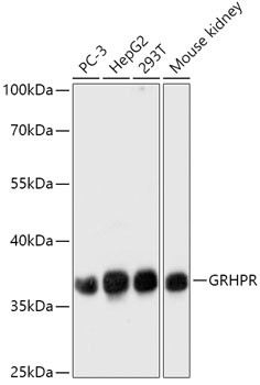 GRHPR Antibody in Western Blot (WB)