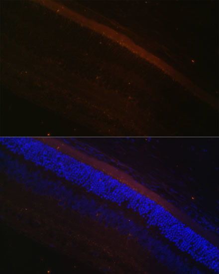 GRK1 Antibody in Immunohistochemistry (Paraffin) (IHC (P))