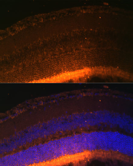 GRK1 Antibody in Immunohistochemistry (Paraffin) (IHC (P))