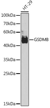 GSDMB Antibody in Western Blot (WB)