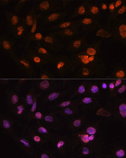 H2AFV Antibody in Immunocytochemistry (ICC/IF)