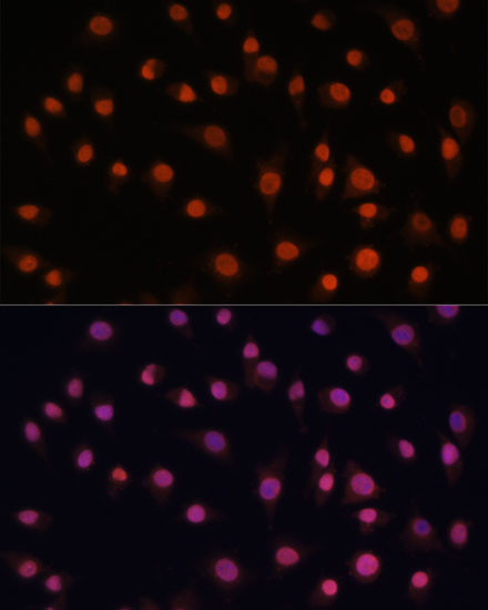 H2AFV Antibody in Immunocytochemistry (ICC/IF)