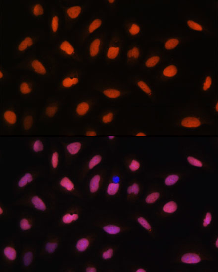 H2AFV Antibody in Immunocytochemistry (ICC/IF)