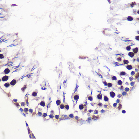 H2AFV Antibody in Immunohistochemistry (Paraffin) (IHC (P))