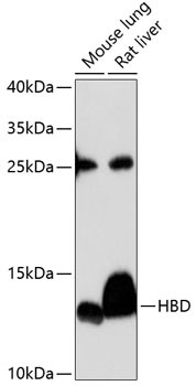 HBD Antibody in Western Blot (WB)
