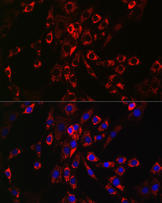 HBEGF Antibody in Immunocytochemistry (ICC/IF)