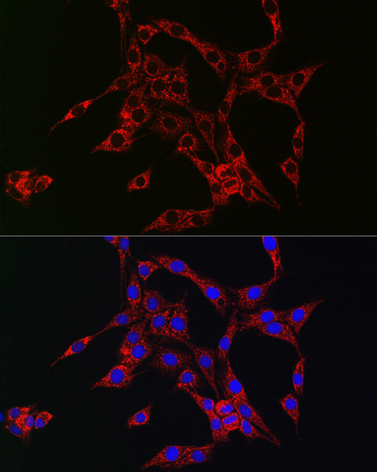 HBEGF Antibody in Immunocytochemistry (ICC/IF)