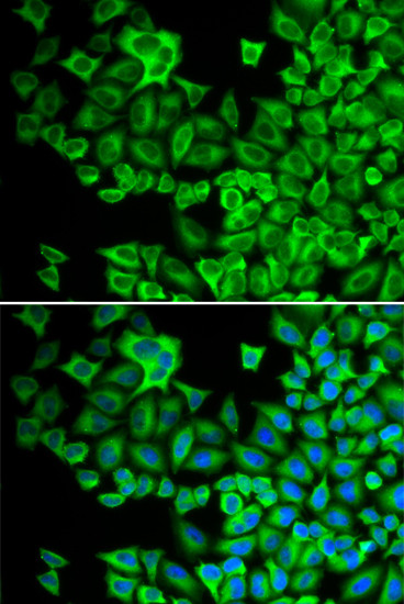 HCK Antibody in Immunocytochemistry (ICC/IF)