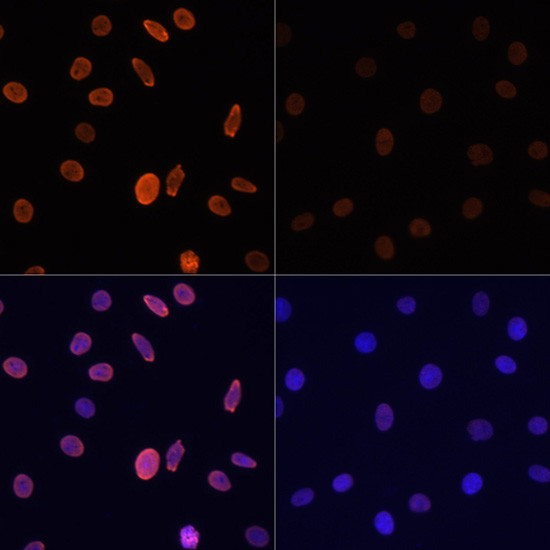 H2BK12ac Antibody in Immunocytochemistry (ICC/IF)