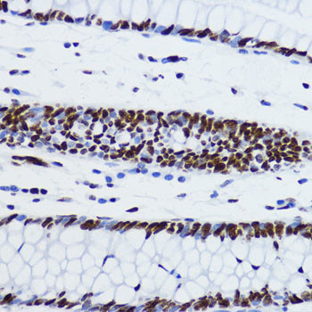 H2BK12ac Antibody in Immunohistochemistry (Paraffin) (IHC (P))