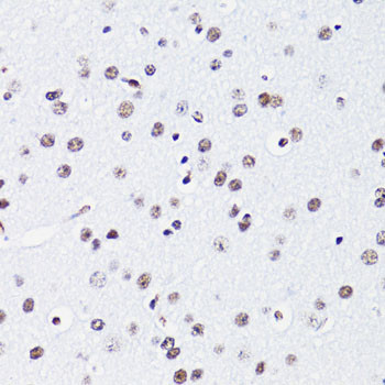 H2BK15ac Antibody in Immunohistochemistry (Paraffin) (IHC (P))