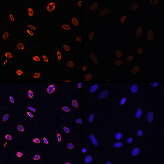 H3K36ac Antibody in Immunocytochemistry (ICC/IF)