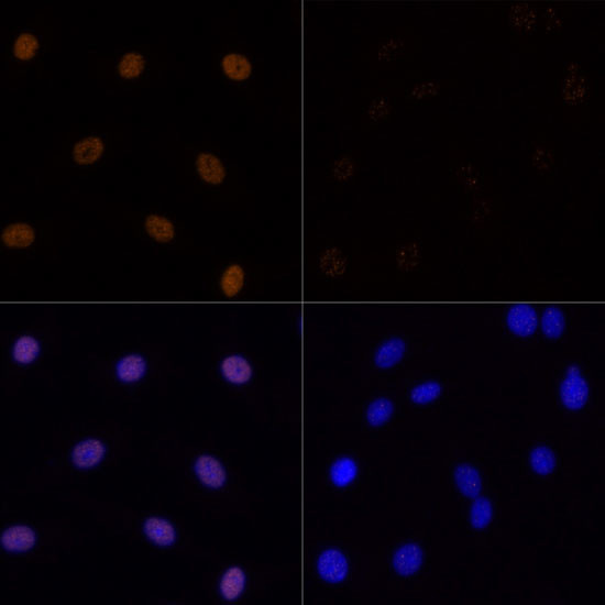 H3K23ac Antibody in Immunocytochemistry (ICC/IF)