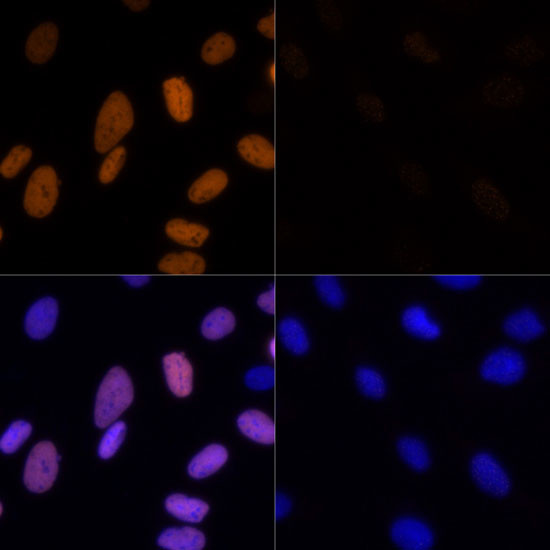 H3K23ac Antibody in Immunocytochemistry (ICC/IF)