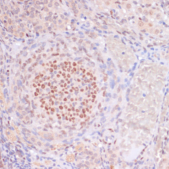 H3K23ac Antibody in Immunohistochemistry (Paraffin) (IHC (P))