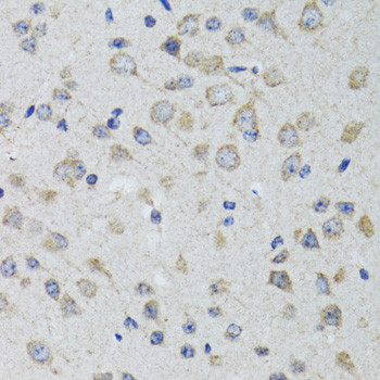 HTR3A Antibody in Immunohistochemistry (Paraffin) (IHC (P))