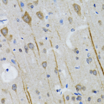 HTR3A Antibody in Immunohistochemistry (Paraffin) (IHC (P))