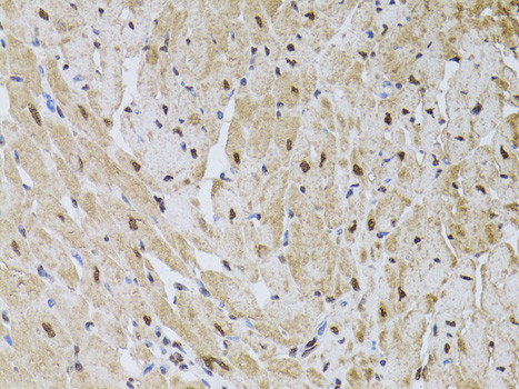 HUS1 Antibody in Immunohistochemistry (Paraffin) (IHC (P))