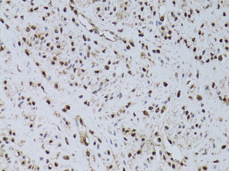 HUS1 Antibody in Immunohistochemistry (Paraffin) (IHC (P))