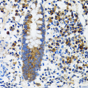 HYOU1 Antibody in Immunohistochemistry (Paraffin) (IHC (P))