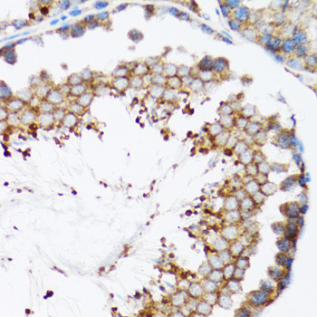 HYOU1 Antibody in Immunohistochemistry (Paraffin) (IHC (P))