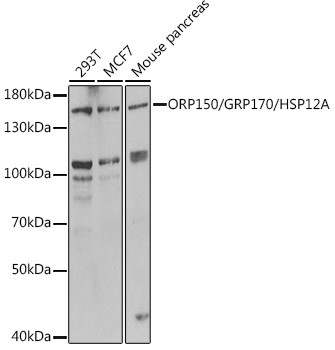 HYOU1 Antibody in Western Blot (WB)