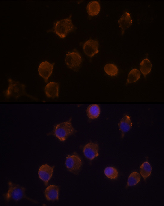 IL10RA Antibody in Immunocytochemistry (ICC/IF)