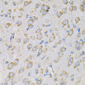 IL10RA Antibody in Immunohistochemistry (Paraffin) (IHC (P))