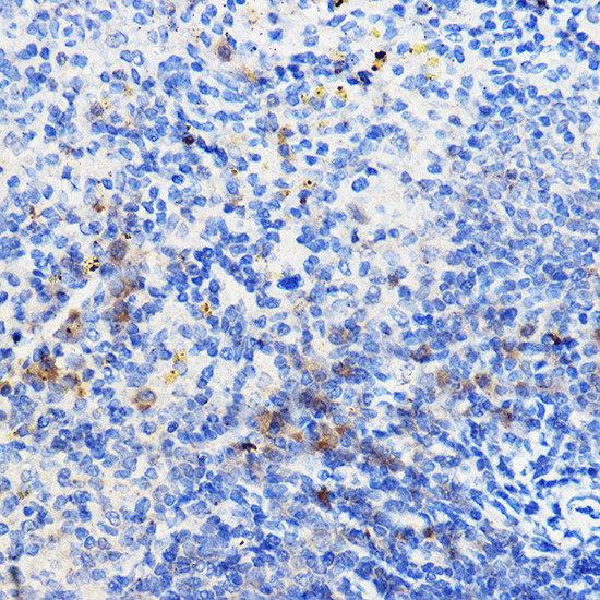 IL24 Antibody in Immunohistochemistry (Paraffin) (IHC (P))