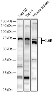 IL6R Antibody in Western Blot (WB)