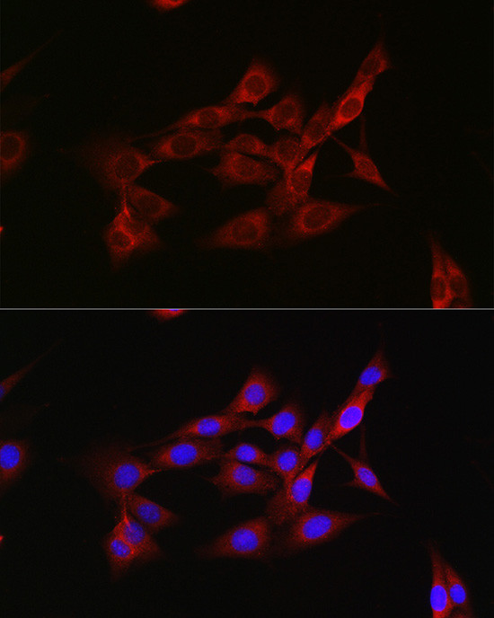 Activin A Antibody in Immunocytochemistry (ICC/IF)