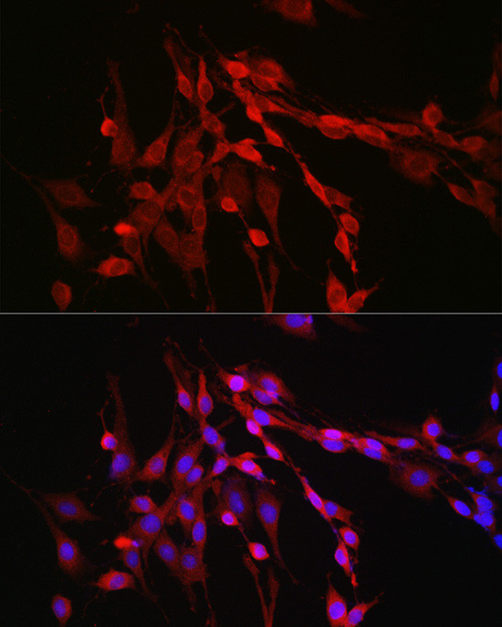 Activin A Antibody in Immunocytochemistry (ICC/IF)