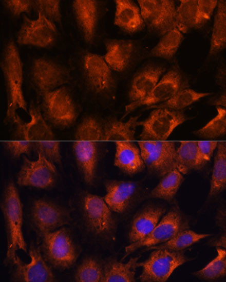 INPP5E Antibody in Immunocytochemistry (ICC/IF)