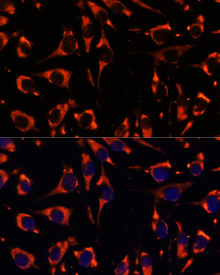 INPP5E Antibody in Immunocytochemistry (ICC/IF)