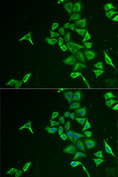 INPP5J Antibody in Immunocytochemistry (ICC/IF)